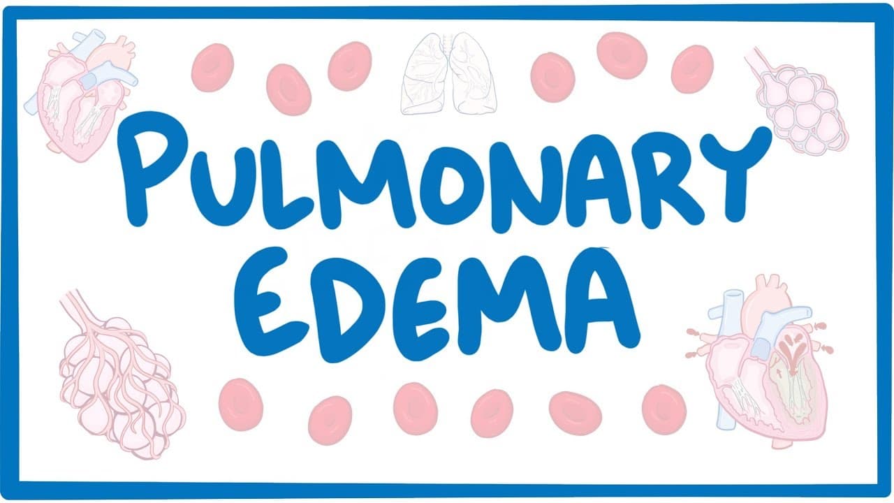 Pulmonary Edema Treatment – Rajveer Bali